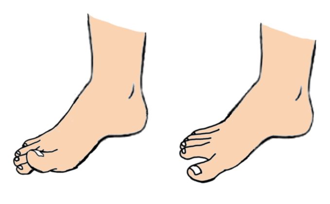 toe toe